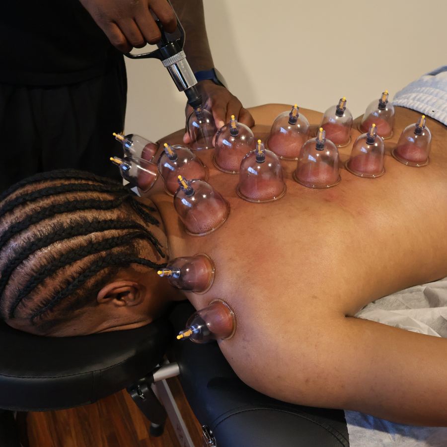 Cupping session on an athlete's back